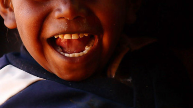 Researchers have shown simple interventions in children’s dental health in remote Indigenous communities have positive ongoing effects.