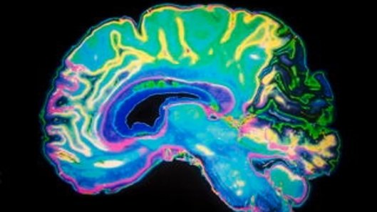 A coloured MRI scan of the human brain.