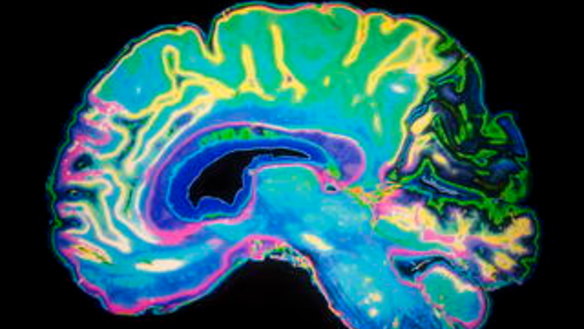 The AFL is aiming for a more coordinated response to issues relating to concussion and head trauma.