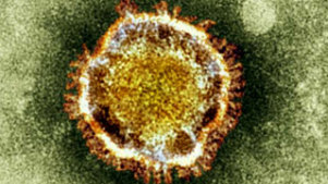A coronavirus.