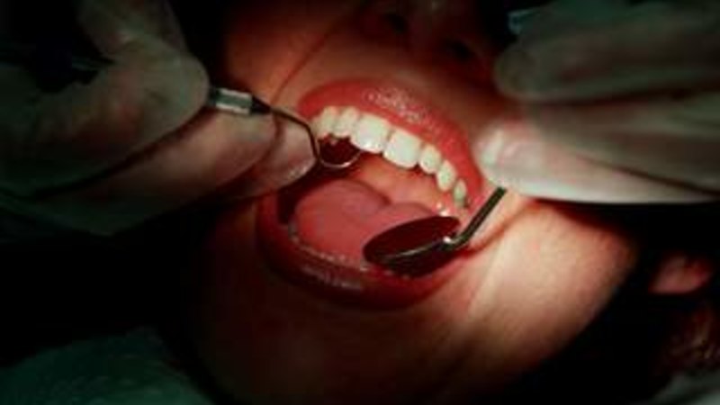 ‘Who will staff them?' Dentists slam Labor's promise of free dental care