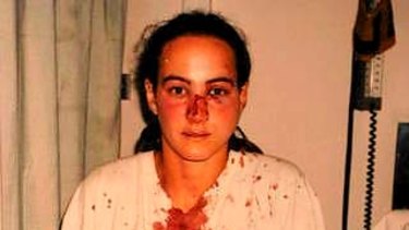 Corinna Horvath after she was allegedly assaulted by police.
