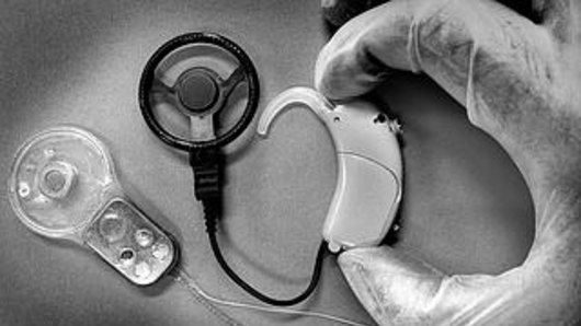 Cochlear is being sued over four process patent infringements, which have expired since the court case began.