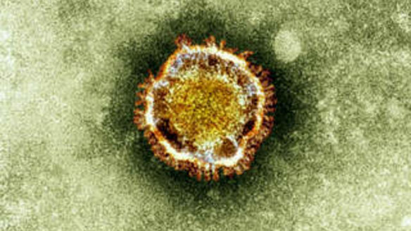 An electron microscope image of a coronavirus, part of a family of viruses that cause ailments including the common cold and SARS, which was first identified last year in the Middle East.