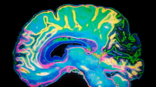 The AFL is aiming for a more coordinated response to issues relating to concussion and head trauma.