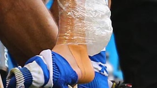 Andrew Swalllow's left foot is bound with an ice pack after his injury.