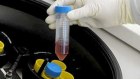 Mesoblast's stem cells are derived from bone marrow. 