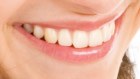 Private equity firm Crescent Capital Partners owns National Dental Care, which has been sinking its teeth into dozens of dental practices and now owns 34 of them in Australia's $9 billion dental sector.