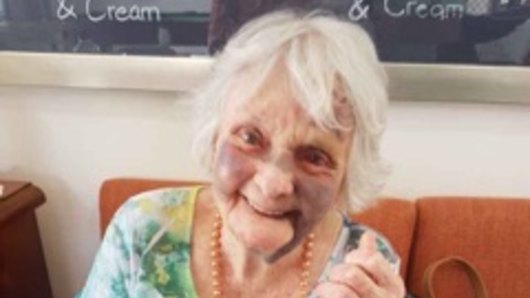 'No honesty comes out' - inquiry into 87-year-old's bruised face