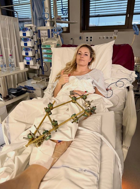 American ski star Lindsey Vonn has gone under the knife.