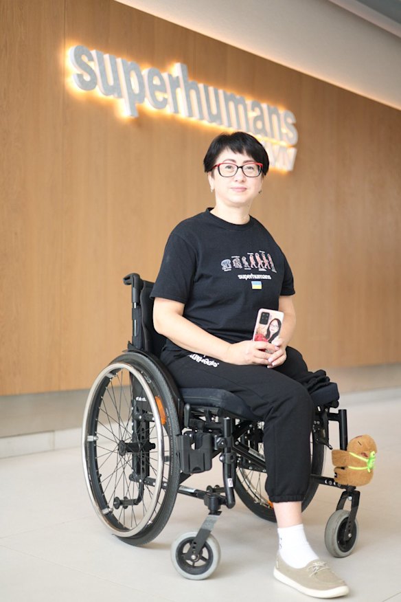 Iryna Nakonechna is waiting for her left leg to heal before being fitted with an electronic knee.