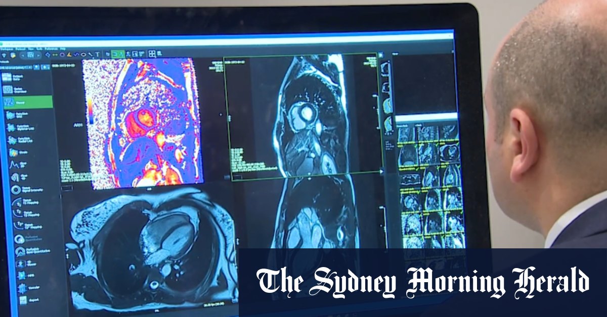 Dementia now leading cause of death