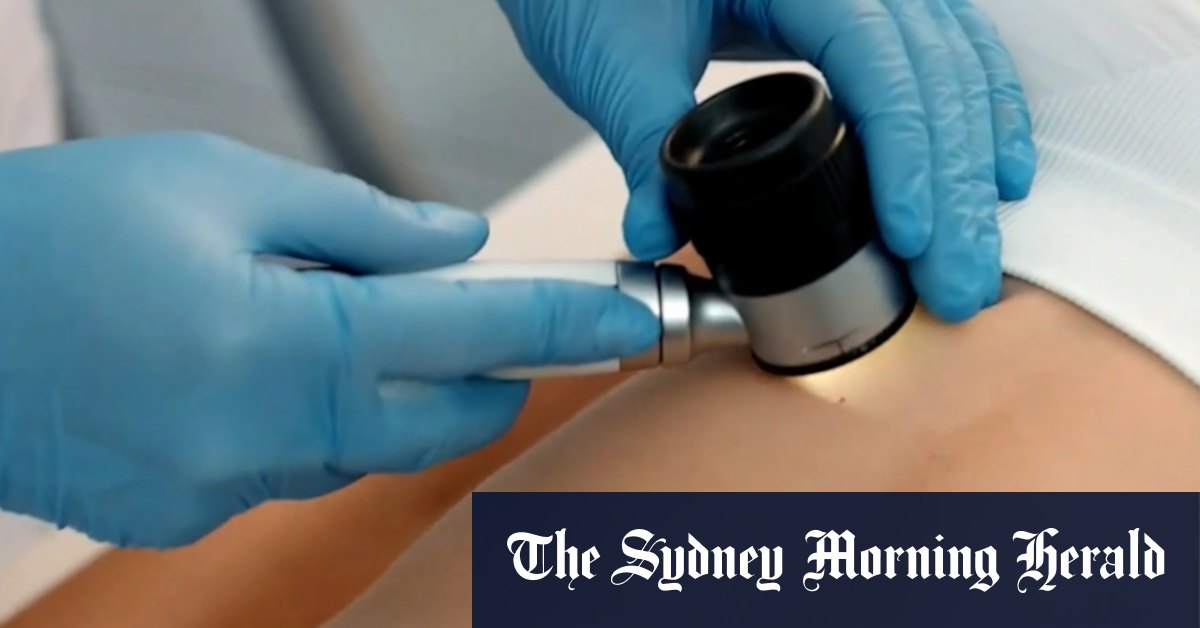 Free online tool could save lives from cancer