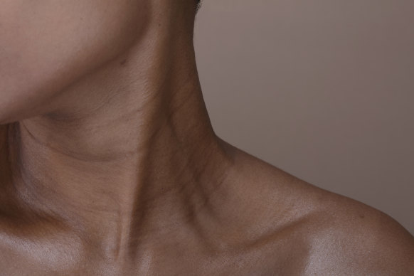 As we age, our neck muscles weaken over time, causing vertical bands and horizontal necklace lines.