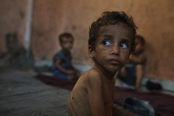 Yazan Abu Ful, a two-year-old malnourished child, sits at his family home in the Shati refugee camp in Gaza City on Wednesday.