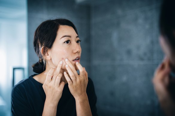 Adult acne is more often inflammatory and hormonally driven.