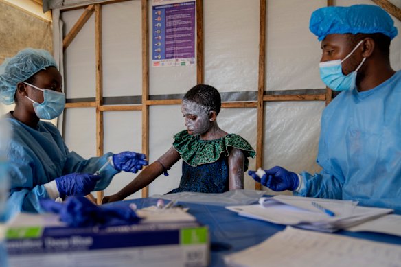 Thousands of people have suffered from mpox in places such as eastern Congo.