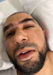 Usman Malik is recovering in hospital.