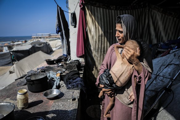 Having dropped from 9 to 6 kilograms, 1½-year-old Muhammad Zakariya Ayyoub al-Matouq faces life-threatening malnutrition as the humanitarian situation in Gaza worsens.