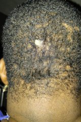 A bullet remains lodged in the back of Jay Wilson's head.