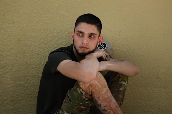 Drone pilot Nazar is in Sydney for reconstruction surgery for wounds he sustained on the front lines.