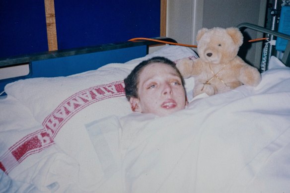 Up to 65 per cent of Arthur’s body was burnt in the fire.