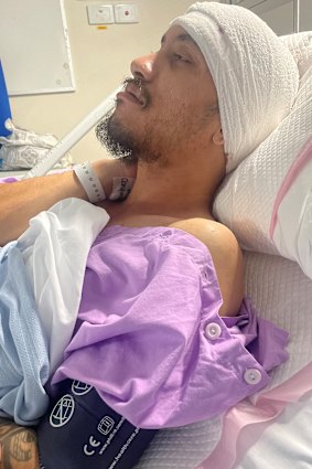 Josh after his brain surgery in April. 