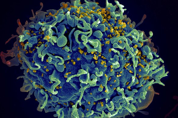 This electron microscope image shows a human T cell, in blue.