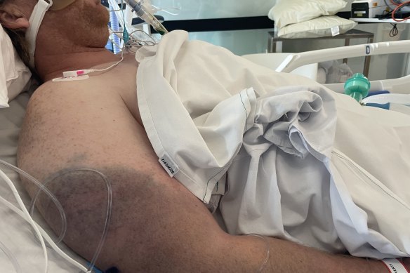 Briggs in hospital.