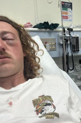 Will Salter in hospital after the Sorrento fight.