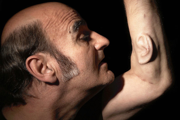 Stelarc with his “third ear”, which was sewn into his arm. Sadly, it never quite worked as intended.