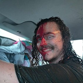 Krunchy Kandy employee Caleb sustained a gash to his head and possible broken hand while attempting to help other businesses in Esk.