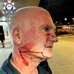 An AFP officer stabbed in the face and neck at Perth Airport by disruptive passenger.