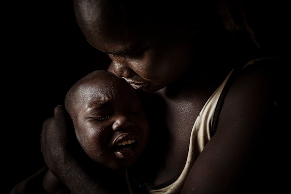Teddy embraces her five-year-old son Moses as he winces in pain from the sores on the back of his head.