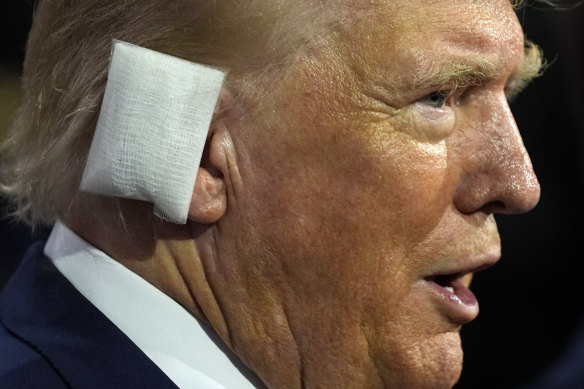A close-up of the bandage on Trump’s ear.