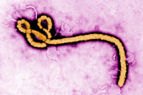 This undated colourised transmission electron micrograph file image made available by the Centres for Disease Control and Prevention shows an Ebola virus virion. 