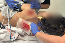Victoria Police are appealing for public assistance after a teenage boy was viciously stabbed and had his e-bike stolen in Wantirna in June.