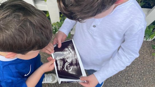 Photo from Princess Eugenie Instagram showing ultrasound after announcing she was pregnant.