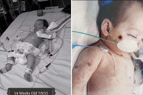 Alijana was just 13 weeks old when she was diagnosed.