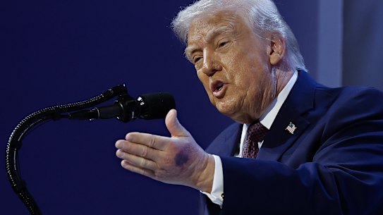 A bruise can be seen on the back of Trump’s left hand during a signing ceremony for the “Board of Peace” at the World Economic Forum in January.