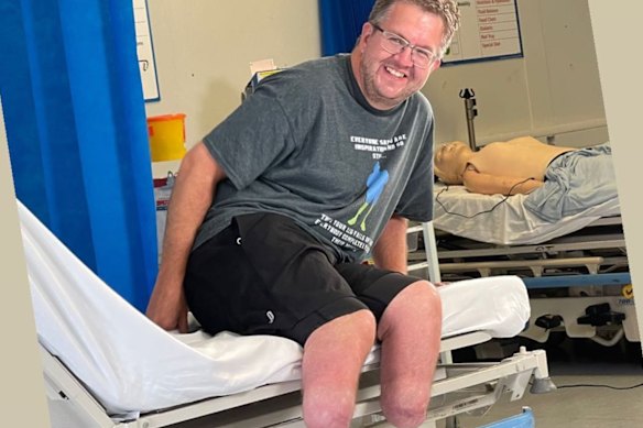 Dr Neil Hopper posted images to social media showing his recovery from double amputation surgery.