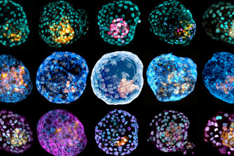 Les embryons modèles, avec une coloration des protéines mettant en évidence différents types de cellules.