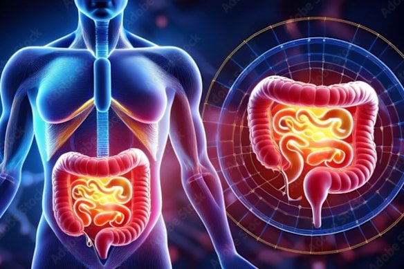 NeuroScientific Biopharmaceuticals will start trialling its proprietorial stem cell therapy for the first time on patient suffering from acute Crohn’s disease. 