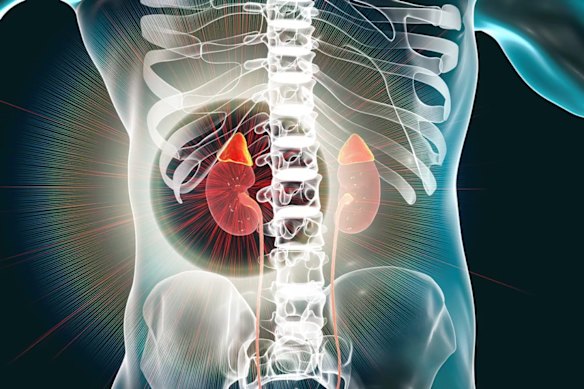 Vectus Biosystems has sold its renal fibrosis molecule to NASDAQ-listed XORTX for $4.5 million.