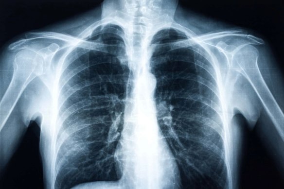 Enlitic’s AI-imaging technology has been whitelisted by health technology major Royal Phillips as one of two products globally to manage its radiology imaging empire. 