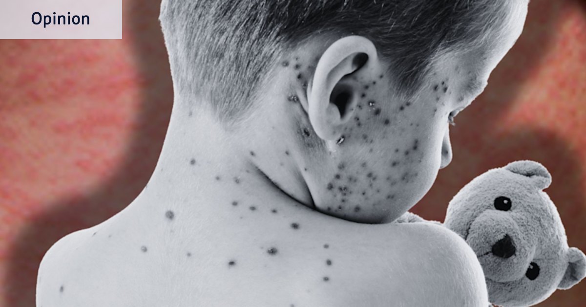 This is the damage RFK Jnr has done in less than a year