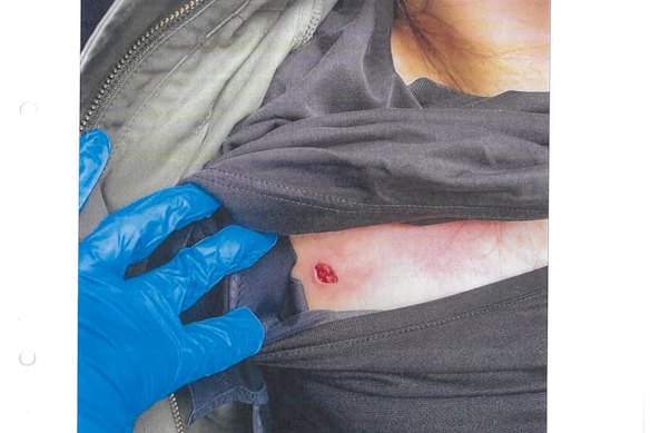 Wan Lai was stabbed as she walked along Little Bourke Street in October.