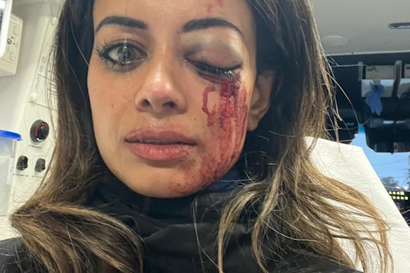 Hannah Thomas, with a bruised and swollen eye and a bloodied face, sits in an ambulance after being arrested during a protest in Belmore on Friday.