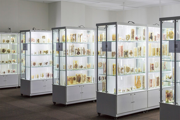 Ainsworth backing  has helped sphere  the Ainsworth Interactive Collection of Medical Pathology that comprises 1600 preserved aesculapian  specimens.