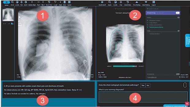  (1) chest X-ray viewer; (2) AI findings viewer; (3) description of the patient’s complaint, symptoms and observations; and (4) a response panel for recording diagnosis.